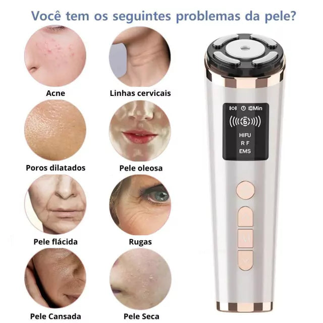 Mini Hifu Ultrassom Portátil Microfocado Para O Rosto