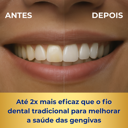 Irrigador Dental Waterpik Jetfloss Ultra