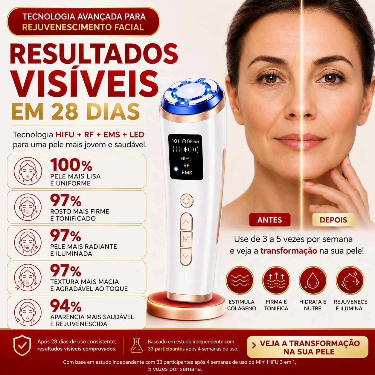 Mini Hifu Ultrassom Portátil Microfocado Para O Rosto