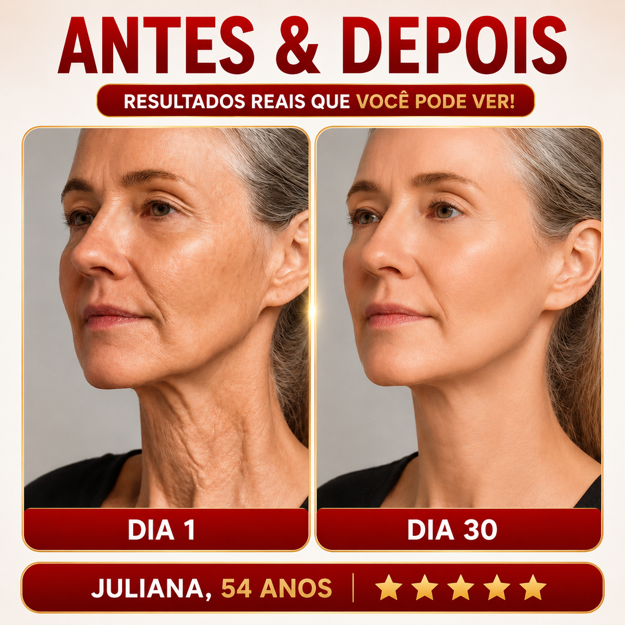 Mini Hifu Ultrassom Portátil Microfocado Para O Rosto