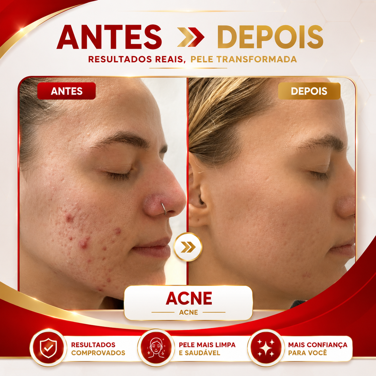 Máscara Facial de Luz LED - DermaLux™