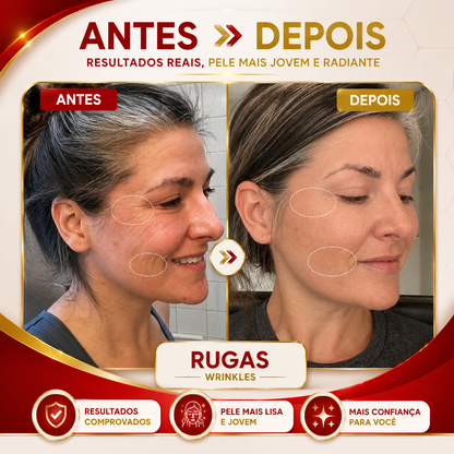 Máscara Facial de Luz LED - DermaLux™