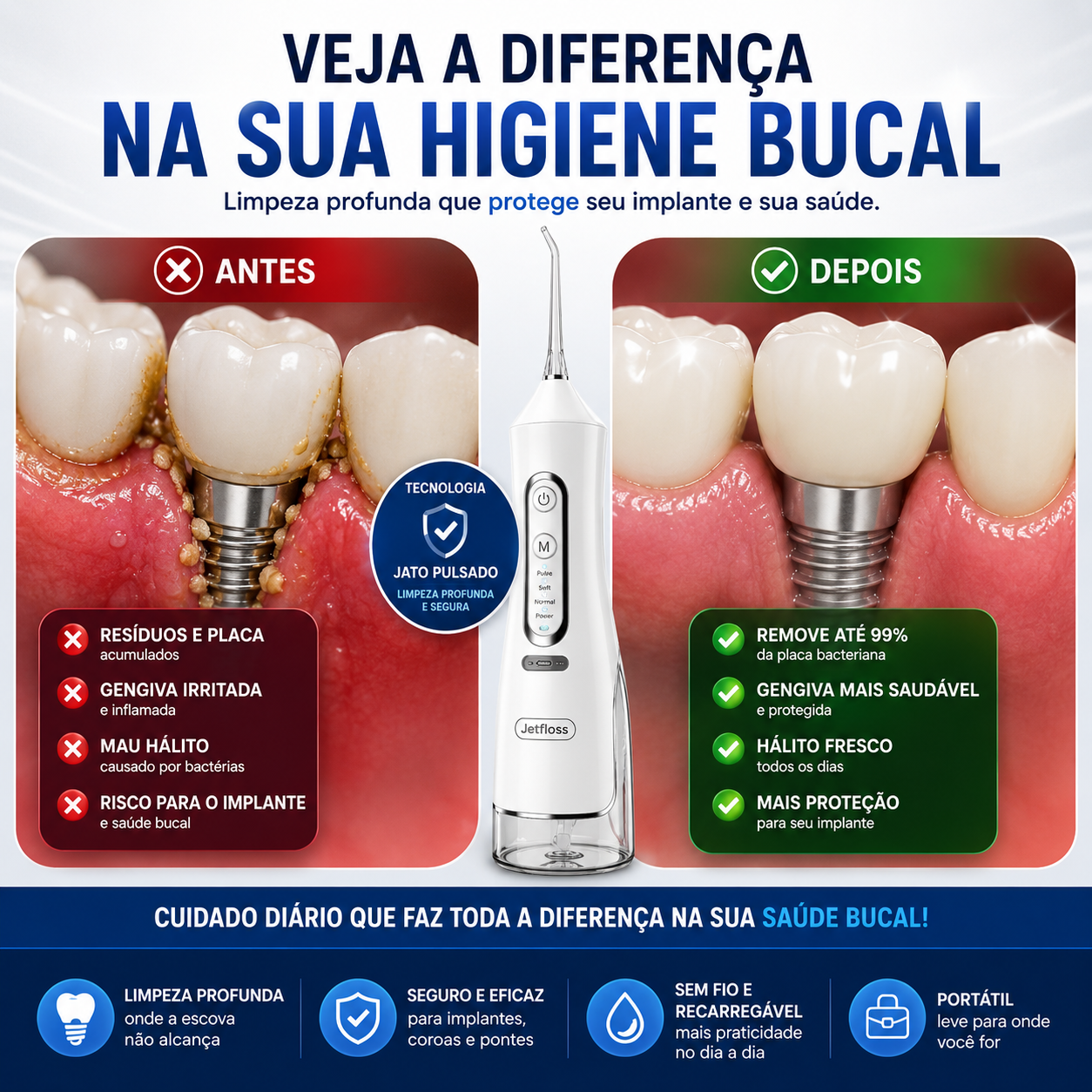 irrigador dental para implante