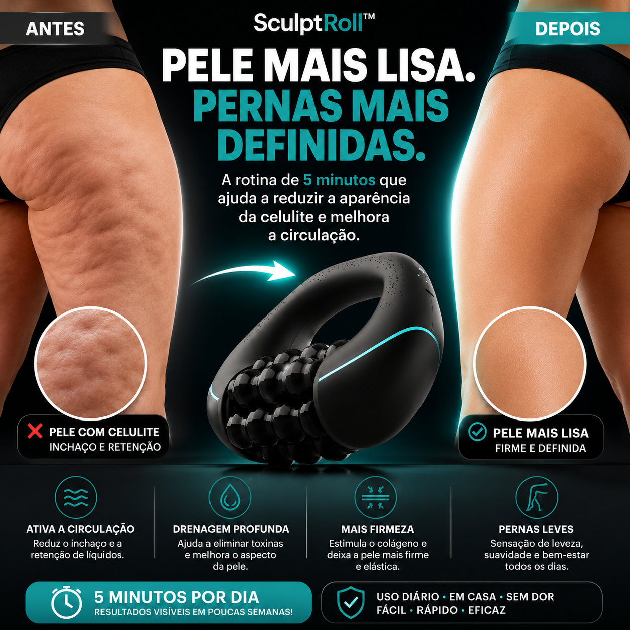 SculptRoll™ - Massageador Para Lipedema e Celulite