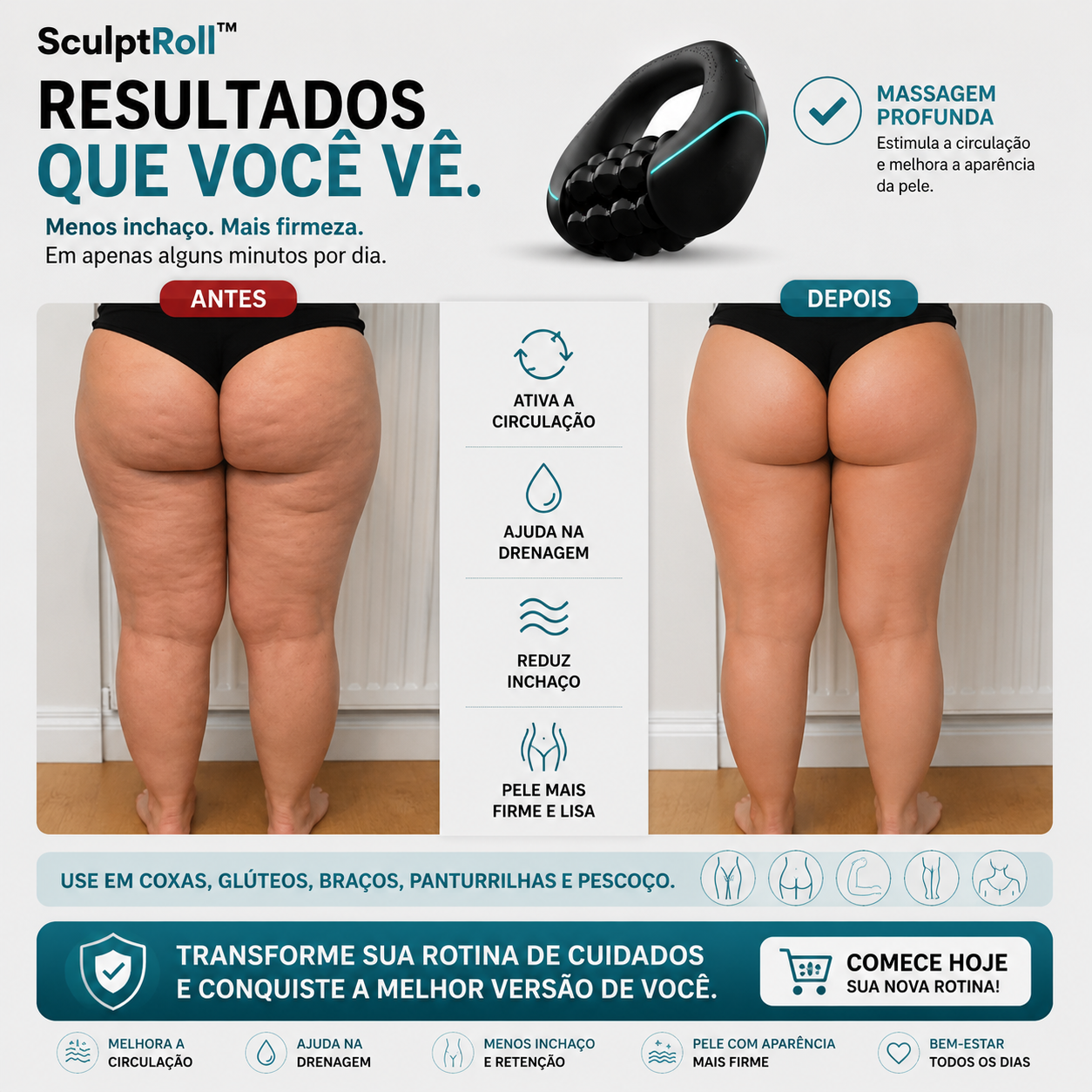 SculptRoll™ - Massageador Para Lipedema e Celulite