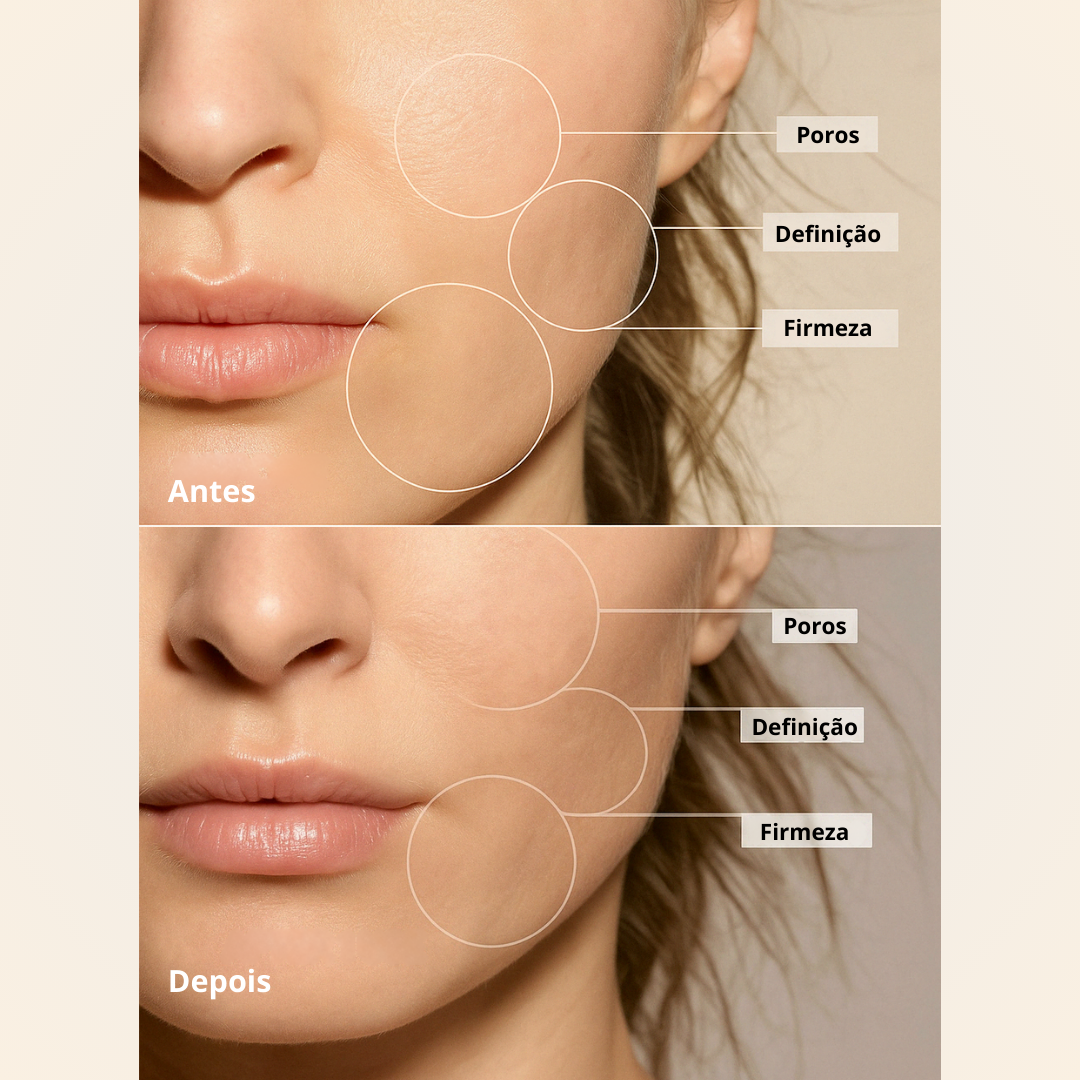 Escultor facial LED LUMINESCE 3 em 1