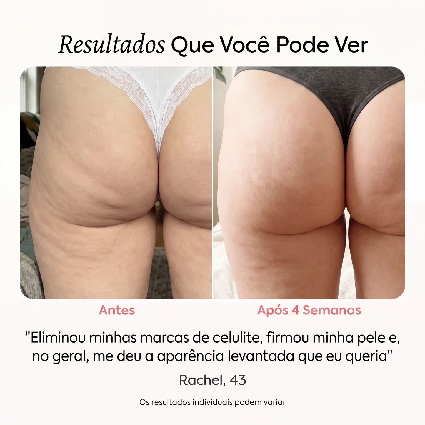 ReduSculpt