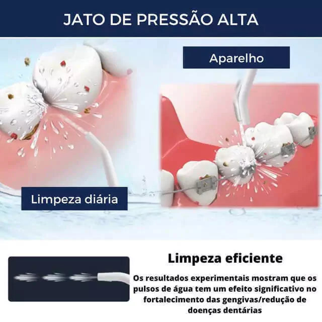 Irrigador Oral Jetfloss