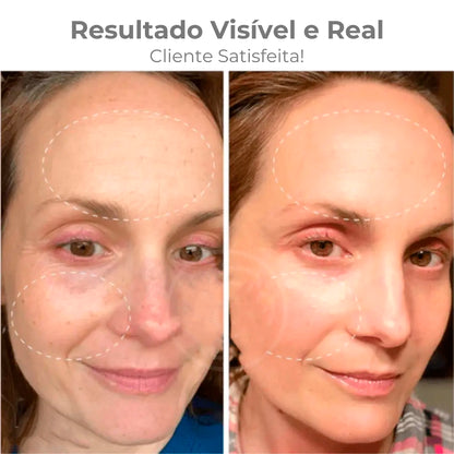 Escultor facial LED LUMINESCE 3 em 1