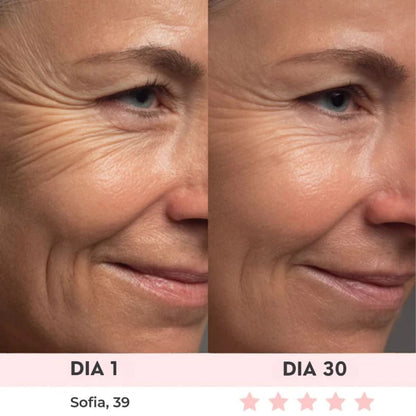 Lift Facial com HIFU – Tecnologia que Ativa o Colágeno e Rejuvenesce o Rosto
