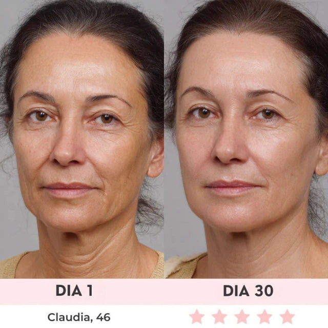 Lift Facial com HIFU – Tecnologia que Ativa o Colágeno e Rejuvenesce o Rosto