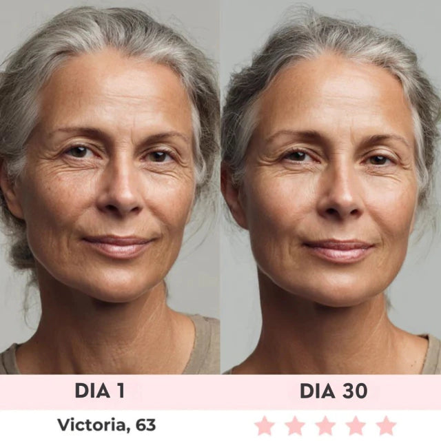 Lift Facial com HIFU – Tecnologia que Ativa o Colágeno e Rejuvenesce o Rosto