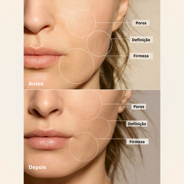 massageador facial com fototerapia anti-rugas