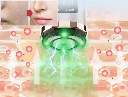 Mini Hifu Ultrassom Portátil Microfocado Para O Rosto